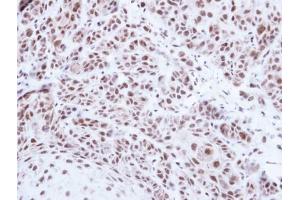 IHC-P Image Immunohistochemical analysis of paraffin-embedded Cal27 xenograft , using PRPF39, antibody at 1:500 dilution. (PRPF39 antibody)