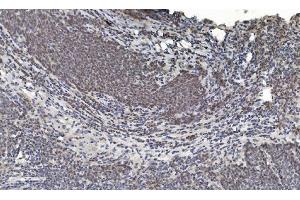 IHC analysis of HDAC5 using anti-HDAC5 antibody (ABIN7599922). (HDAC5 antibody  (AA 13-1107))
