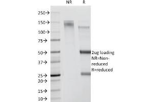 SDS-PAGE Analysis Purified CDw78 Monoclonal Antibody (DF1588). (CDw78 antibody)