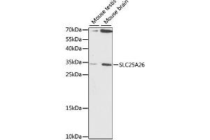 Western blot analysis of extracts of various cell lines, using SLC25A26 antibody. (SLC25A26 antibody)