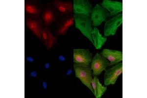 ABIN7094772 and ABIN7098823 staining  cells by IF/ICC.