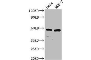 Western Blot Positive WB detected in: Hela whole cell lysate, MCF-7 whole cell lysate All lanes: NSUN5 antibody at 2. (NSUN5 antibody  (AA 362-466))