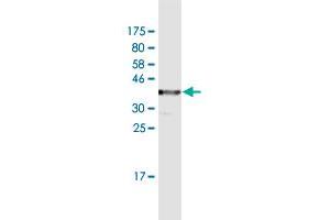 Western Blot detection against Immunogen (36. (TCIRG1 antibody  (AA 121-220))