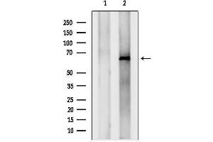 Western blot analysis of lysates from MCF7, using IGF2BP1 Antibody.