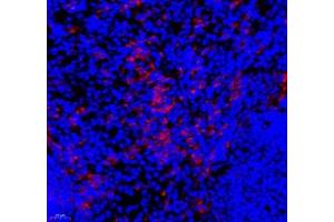 Immunofluorescence of paraffin embedded mouse spleen using IL-27A (ABIN7074367) at dilution of 1: 800 (400x lens) (IL27 antibody)