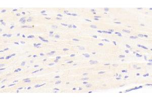 Detection of LAMb1 in Mouse Cardiac Muscle Tissue using Polyclonal Antibody to Laminin Beta 1 (LAMb1) (Laminin beta 1 antibody  (AA 1053-1258))