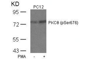 Western blot analysis of extracts from PC12 cells untreated or treated with PMA using PKCth(Phospho-Ser676) Antibody. (PKC theta antibody  (pSer676))