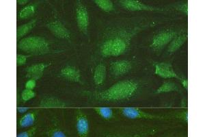 Immunofluorescence analysis of U-2OS cells using NHEJ1 Polyclonal Antibody at dilution of 1:100. (NHEJ1 antibody)