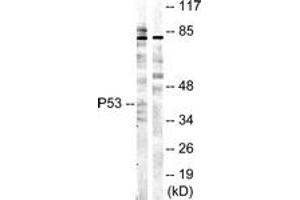 Western blot analysis of extracts from COS7 cells, treated with UV 5', using p53 (Ab-20) Antibody. (p53 antibody  (AA 10-59))