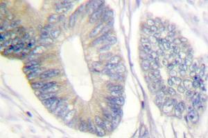 Image no. 1 for anti-SHC (Src Homology 2 Domain Containing) Transforming Protein 1 (SHC1) antibody (ABIN271910)