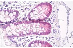 Image no. 1 for anti-Glutathione Peroxidase 2 (GPX2) antibody (ABIN1502290) (Glutathione Peroxidase 2 antibody)