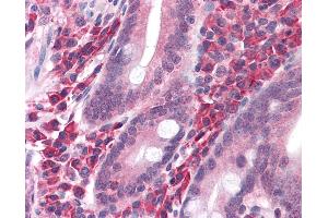 Immunohistochemistry (IHC) image for anti-Solute Carrier Family 20 (Phosphate Transporter), Member 1 (SLC20A1) (AA 262-517) antibody (ABIN604920)