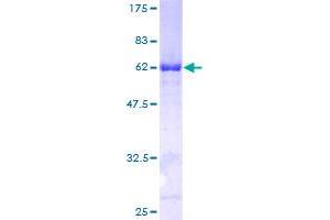 Image no. 1 for Nicotinamide phosphoribosyltransferase (NAMPT) (AA 1-368) protein (GST tag) (ABIN1311948)