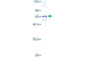 Image no. 1 for Transcriptional Adaptor 2A (TADA2A) (AA 1-305) protein (GST tag) (ABIN1322058) (TADA2L Protein (AA 1-305) (GST tag))