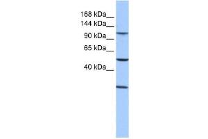 STAG3 antibody used at 1 ug/ml to detect target protein. (STAG3 antibody  (Middle Region))