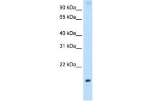 Western Blotting (WB) image for anti-Protein Phosphatase 1, Regulatory Subunit 8 (PPP1R8) antibody (ABIN2462127) (PPP1R8 antibody)