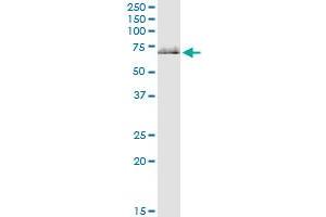 Immunoprecipitation of GPT2 transfected lysate using anti-GPT2 MaxPab rabbit polyclonal antibody and Protein A Magnetic Bead , and immunoblotted with GPT2 purified MaxPab mouse polyclonal antibody (B01P) . (GPT2 antibody  (AA 1-523))