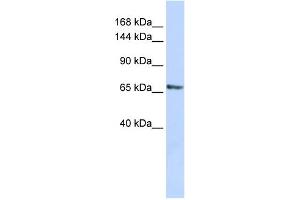 WB Suggested Anti-RBM26 Antibody Titration:  0. (RBM26 antibody  (Middle Region))