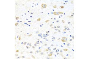 Immunohistochemistry of paraffin-embedded mouse brain using INPP5K antibody (ABIN5975191) at dilution of 1/100 (40x lens).