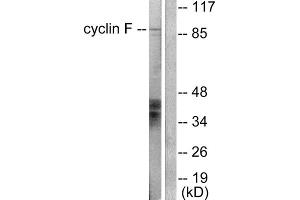 Western blot analysis of extracts from HeLa cells, using Cyclin F antibody (ABIN5976376). (Cyclin F antibody  (C-Term))