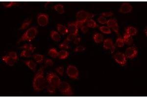 ABIN6276072 staining LOVO by IF/ICC. (OR11L1 antibody  (Internal Region))