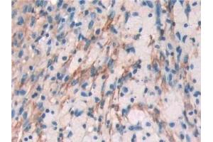 Immunohistochemistry (IHC) image for anti-Filamin A, alpha (FLNA) (AA 2-274) antibody (ABIN7440788)
