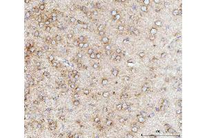 IHC analysis of MFF using anti-MFF antibody (ABIN7599292). (MFF antibody  (AA 1-342))