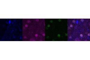 Immunohistochemistry (IHC) image for anti-SATB Homeobox 2 (SATB2) antibody (ABIN7456088) (SATB2 antibody)