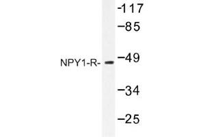 Image no. 1 for anti-Neuropeptide Y Receptor 1 (NPY1R) antibody (ABIN317656) (NPY1R antibody)