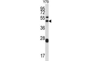 Western Blotting (WB) image for anti-Actin Related Protein 2/3 Complex, Subunit 1A, 41kDa (ARPC1A) antibody (ABIN3002660) (ARPC1A antibody)
