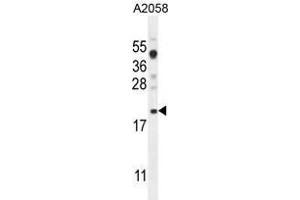 VCX1 Antibody (N-term) western blot analysis in A2058 cell line lysates (35 µg/lane). (VCX antibody  (N-Term))