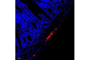 Immunofluorescent analysis of paraffin embedded rat colon using peripherin (ABIN7075012) at dilution of 1: 1600 (Peripherin antibody)