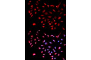 Immunofluorescence analysis of U2OS cells using CDK9 antibody (ABIN5970745). (CDK9 antibody)