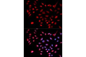 Immunofluorescence analysis of U2OS cells using CDK9 antibody (ABIN5970745). (CDK9 antibody)