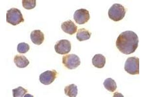 Immunocytochemistry of DR4 in Jurkat cells with AP30299PU-N DR4 antibody at 10 μg/ml. (TNFRSF10A antibody  (C-Term))