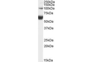 Image no. 1 for anti-HNF1 Homeobox B (HNF1B) (Internal Region) antibody (ABIN375249) (HNF1B antibody  (Internal Region))