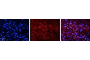 Rabbit Anti-DND1 Antibody     Formalin Fixed Paraffin Embedded Tissue: Human Pineal Tissue  Observed Staining: Cytoplasmic in pinealocytes  Primary Antibody Concentration: 1:100  Other Working Concentrations: 1/600  Secondary Antibody: Donkey anti-Rabbit-Cy3  Secondary Antibody Concentration: 1:200  Magnification: 20X  Exposure Time: 0. (DND1 antibody  (C-Term))