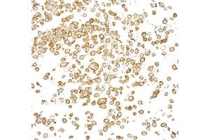 Immunocytochemistry (ICC) image for anti-Epidermal Growth Factor Receptor (EGFR) (C-Term) antibody (ABIN7795642) (Recombinant EGFR antibody  (C-Term))