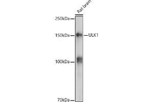 Western blot analysis of extracts of Rat brain, using ULK1 antibody (ABIN6134005, ABIN6149921, ABIN6149922 and ABIN6224624) at 1:500 dilution. (ULK1 antibody  (AA 400-499))