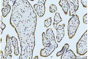 IHC analysis of MOV10 using anti-MOV10 antibody (ABIN7600236). (MOV10 antibody  (AA 167-772))