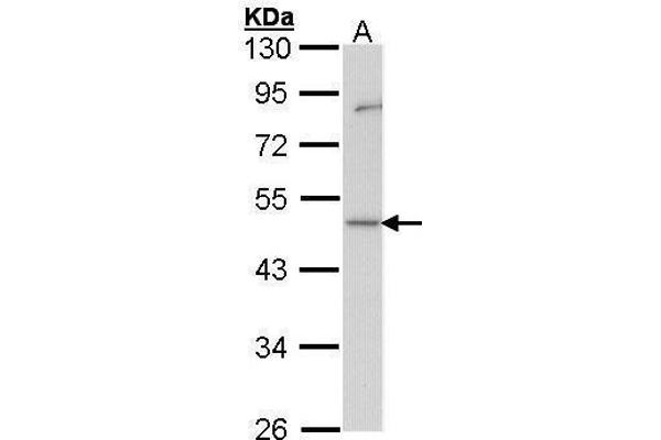 GDI1 antibody