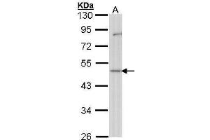 WB Image Sample (30 ug of whole cell lysate) A: Hep G2 , 10% SDS PAGE antibody diluted at 1:1000 (GDI1 antibody)