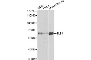 Western blot analysis of extracts of various cell lines, using GLB1 antibody. (GLB1 antibody)