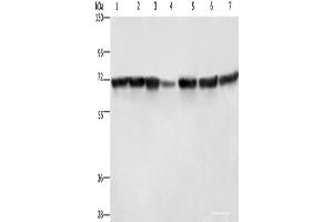 Western blot analysis of Hela cells HT29 cells human fetal liver tissue Human testis tissue 231 cells K562 cells human bladder transitional cell carcinoma tissue using LMNB1 Polyclonal Antibody at dilution of 1:750