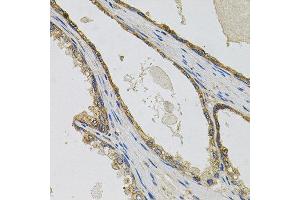 Immunohistochemistry of paraffin-embedded human prostate using PTK7 antibody at dilution of 1:100 (x40 lens).