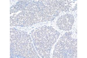 anti-Superkiller Viralicidic Activity 2-Like 2 (SKIV2L2) (AA 100-150) antibody