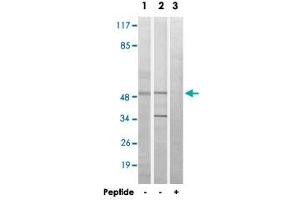Western blot analysis of extracts from HeLa cells (Lane 1) and Jurkat cells (Lane 2 and lane 3), using MYLIP polyclonal antibody .