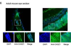 Immunofluorescence of Rabbit anti-CASZ1 Antibody. (CASZ1 antibody  (Internal Region))