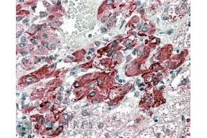 Immunohistochemistry (IHC) image for anti-Solute Carrier Family 18 (Vesicular Monoamine Transporter), Member 2 (SLC18A2) (C-Term) antibody (ABIN570915)