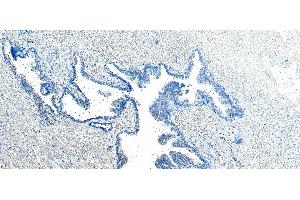 (ABIN185182) Negative Control showing staining of paraffin embedded Human Prostate, with no primary antibody. (VPS35 antibody  (C-Term))